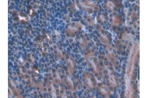 DAB staining on IHC-P; Samples: Mouse Kidney Tissue (TOR1AIP2 antibody  (AA 250-475))