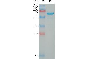 WFDC1 Protein (AA 32-220) (Fc Tag)