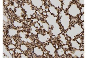 ABIN6272982 at 1/100 staining Mouse lung tissue by IHC-P. (TELO2 antibody  (Internal Region))