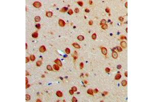 Immunohistochemical analysis of ERAP1 staining in human brain formalin fixed paraffin embedded tissue section. (ERAP1 antibody  (Center))