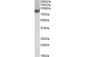 TRIM55 anticorps  (C-Term)