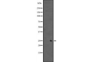 Western blot analysis of MIXL1 expression in Mouse kidney tissue lysates ;,The lane on the left is treated with the antigen-specific peptide. (MIXL1 antibody  (Internal Region))