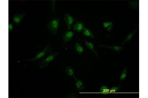 Immunofluorescence of monoclonal antibody to IRX5 on HeLa cell. (IRX5 antibody  (AA 204-264))