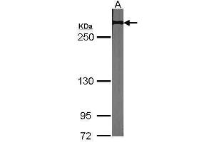 WB Image Sample (30 ug of whole cell lysate) A:NIH-3T3 5% SDS PAGE antibody diluted at 1:1000 (NOTCH2 antibody  (C-Term))