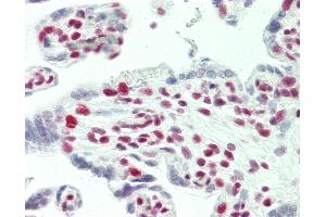 Anti-TCERG1 / CA150 antibody IHC staining of human placenta.