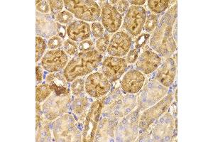 Immunohistochemistry of paraffin-embedded Mouse kidney using FDPS antibody at dilution of 1:100 (x400 lens).