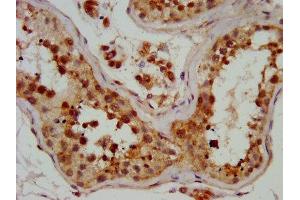 IHC image of ABIN7150641 diluted at 1:700 and staining in paraffin-embedded human testis tissue performed on a Leica BondTM system. (DMRT3 antibody  (AA 92-224))