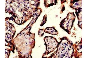 Immunohistochemistry of paraffin-embedded human placenta tissue using ABIN7156442 at dilution of 1:100 (ITGA5 antibody  (AA 220-472))