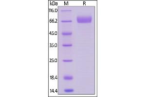 SDS-PAGE (SDS) image for CD33 (CD33) (AA 18-259) (Active) protein (Fc Tag) (ABIN6253597)