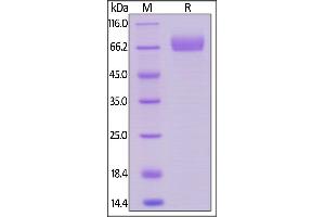 Human Siglec-3, Llama IgG2b Fc Tag, low endotoxin on  under reducing (R) condition.
