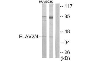 Western Blotting (WB) image for anti-ELAV2/4 (ELAV2/4) (Internal Region) antibody (ABIN1849272) (ELAV2/4 antibody  (Internal Region))
