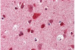 Brain, cortex, Human: Formalin-Fixed, Paraffin-Embedded (FFPE) (Ubiquitin antibody)