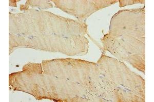 Immunohistochemistry (IHC) image for anti-Microtubule-Associated Protein 1 Light Chain 3 alpha (MAP1LC3A) (AA 1-120) antibody (ABIN7159778)