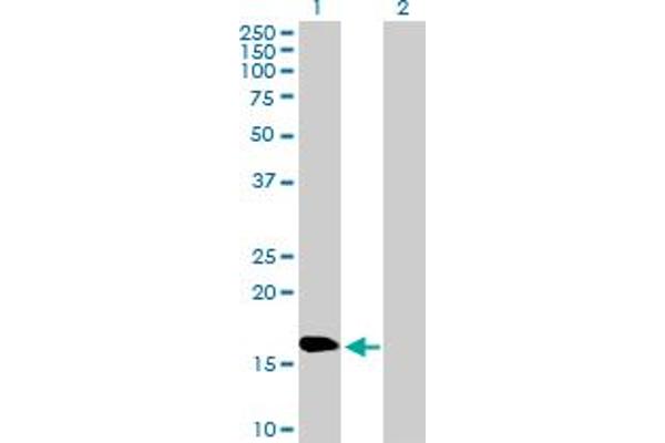 NPC2 antibody  (AA 1-151)