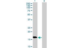 Western Blot analysis of NPC2 expression in transfected 293T cell line by NPC2 MaxPab polyclonal antibody.