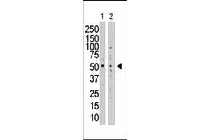 Western blot analysis of SUV39H1 polyclonal antibody  in SAOS-2 cell lysate (Lane 1) and NIH/3T3 cell lysate (Lane 2) . (SUV39H1 antibody  (N-Term))