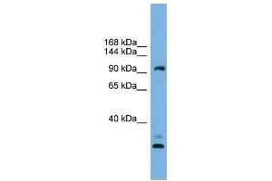 WB Suggested Anti-CCDC110 Antibody Titration: 0. (CCDC110 antibody  (Middle Region))