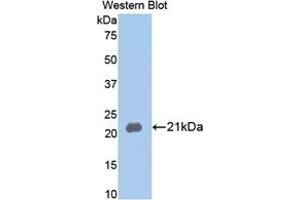 WB of Protein Standard: different control antibodies against Highly purified E. (MMP13 CLIA Kit)
