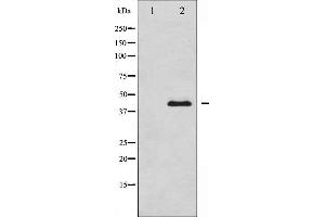 Western blot analysis of MEK1/2 expression in UV treated Jurkat whole cell lysates,The lane on the left is treated with the antigen-specific peptide. (MEK1 antibody  (Internal Region))