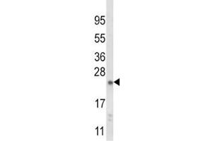 Western blot analysis of NQO2 antibody and mouse liver tissue lysate (NQO2 antibody  (AA 141-168))
