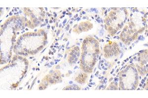 Detection of PRDX6 in Human Stomach Tissue using Polyclonal Antibody to Peroxiredoxin 6 (PRDX6) (Peroxiredoxin 6 antibody  (AA 1-224))