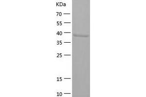 Western Blotting (WB) image for N-Acylsphingosine Amidohydrolase (Acid Ceramidase) 1 (ASAH1) (AA 22-395) protein (His tag) (ABIN7287113) (ASAH1 Protein (AA 22-395) (His tag))
