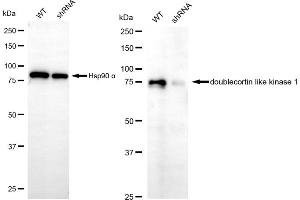 Western blotting analysis using doublecortin like kinase 1 antibody (ABIN7798387).