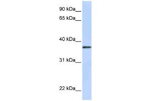 TTMB antibody used at 1 ug/ml to detect target protein. (TMEM200B antibody  (N-Term))