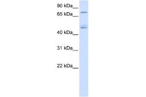 DDX1 antibody used at 1 ug/ml to detect target protein. (DDX1 antibody)