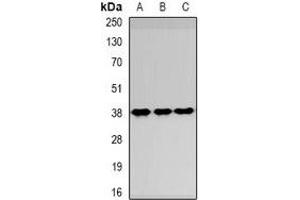 Western blot analysis of SPFH1 expression in HepG2 (A), NIH3T3 (B), Hela (C) whole cell lysates. (ERLIN1 antibody)