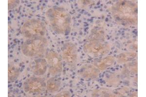 DAB staining on IHC-P; Samples: Human Stomach Tissue (PIGR antibody  (AA 462-561))