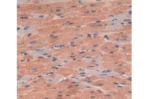 sed in DAB staining on fromalin fixed paraffin- embedded heart tissue (NT5M antibody  (AA 30-193))