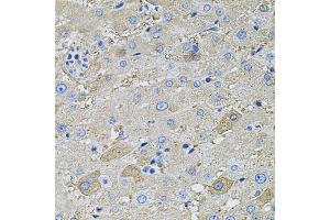 Immunohistochemistry of paraffin-embedded human liver using GLA antibody (ABIN1875410) at dilution of 1:100 (40x lens). (GLA antibody)