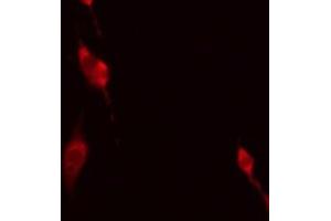 ABIN6275170 staining HeLa by IF/ICC. (GIMAP5 antibody  (Internal Region))