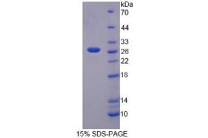 Image no. 1 for Thyroid Stimulating Hormone Receptor (TSHR) (AA 28-245) protein (His tag) (ABIN4989563)
