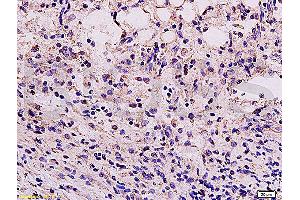 Immunohistochemistry (IHC) image for anti-Vimentin (VIM) (AA 371-466) antibody (ABIN672786)