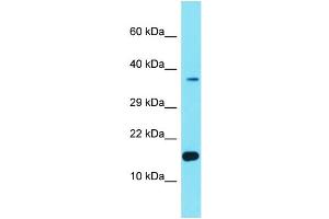 Host: Rabbit Target Name: FER1L6-AS2 Sample Type: Hela Whole cell lysates Antibody Dilution: 1. (FER1L6-AS2 antibody  (Middle Region))