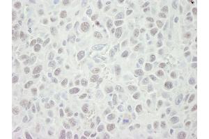 Immunohistochemistry (IHC) image for anti-Minichromosome Maintenance Complex Component 5 (MCM5) (AA 1-50) antibody (ABIN7448655) (MCM5 antibody  (AA 1-50))