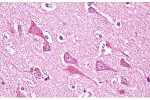 Anti-NDUFS7 antibody IHC staining of human brain, cortex neurons. (NDUFS7 antibody  (AA 58-68))