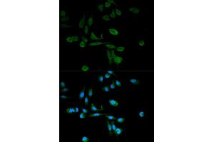 Immunofluorescence analysis of HeLa cells using SIRT7 antibody. (SIRT7 antibody)