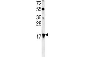 ARF1 antibody western blot analysis in Ramos lysate (ARF1 antibody  (AA 80-106))