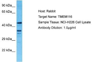 Host: Rabbit Target Name: TMEM116 Sample Tissue: Human NCI-H226 Whole Cell Antibody Dilution: 1ug/ml (TMEM116 antibody  (C-Term))