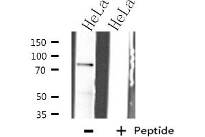 Western blot analysis of IKK-beta expression in HeLa whole cell lysates,The lane on the left is treated with the antigen-specific peptide.