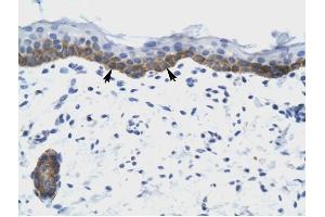 NUDT9 antibody was used for immunohistochemistry at a concentration of 4-8 ug/ml to stain Squamous epithelial cells (arrows) in Human Skin.