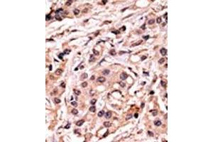 Image no. 1 for anti-Tumor Protein P53 (TP53) (pSer20) antibody (ABIN358188) (p53 antibody  (pSer20))