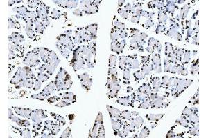 IHC analysis of NCL using anti-NCL antibody (ABIN7600662). (Nucleolin antibody  (AA 219-629))