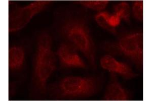 ABL1/2 antibody  (pTyr393, pTyr439)