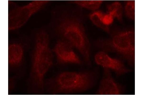 ABL1/2 antibody  (pTyr393, pTyr439)
