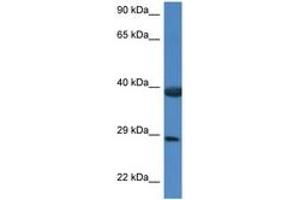 Image no. 1 for anti-HSPA Binding Protein, Cytoplasmic Cochaperone 1 (HSPBP1) (AA 226-275) antibody (ABIN6747386) (HSPBP1 antibody  (AA 226-275))