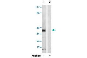 Western blot analysis of extracts from HepG2 cells, using MRPS36 polyclonal antibody . (MRPS36 antibody)